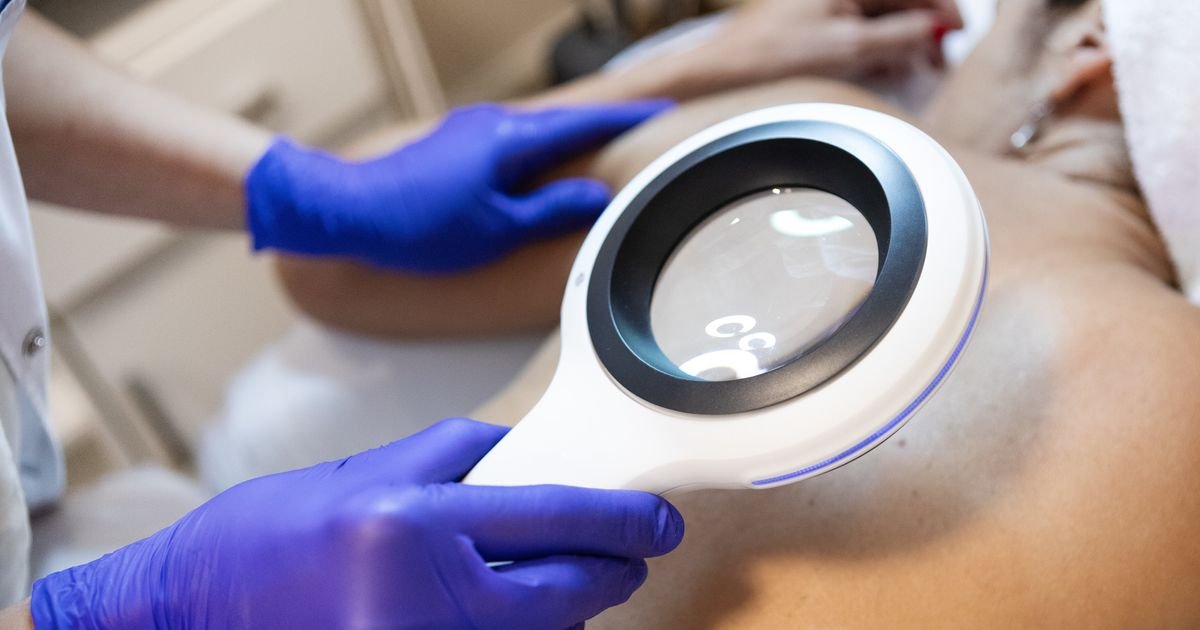 Skin Cancer Doctor Says Tanning Is Dangerous