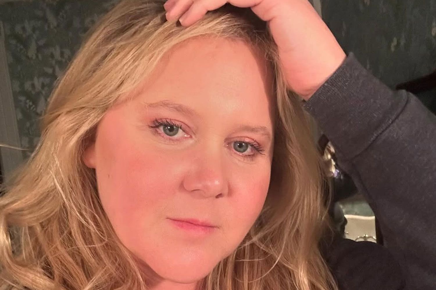 Amy Schumer Posts 'No Filter' Selfie After Cushing Syndrome Discussion