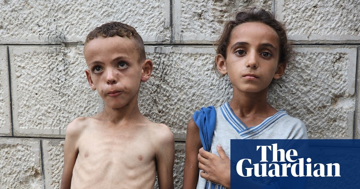 ‘We faced hunger before, but never like this’: skeletal children fill hospital wards as starvation grips Gaza | Gaza