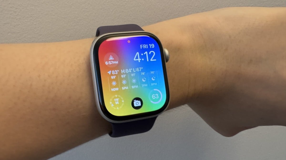 I Love My Apple Watch Series 11, But You Might Not