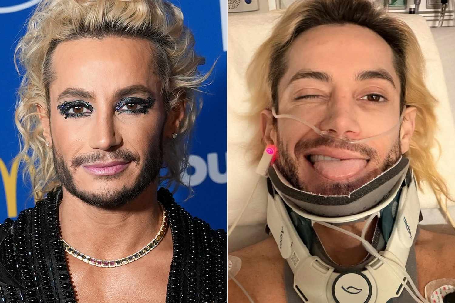 Frankie Grande Undergoes Cervical Spine Surgery
