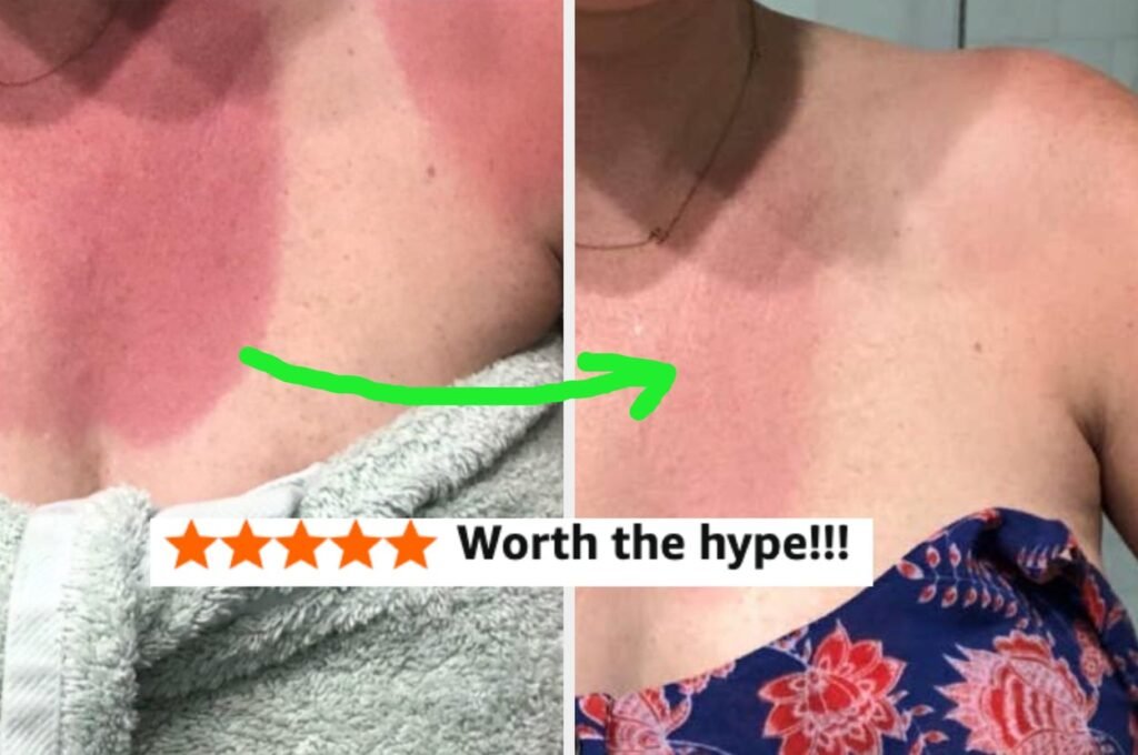 If You’re Traveling This Summer, You’ll Be Very Smug You Bought These 33 Products First