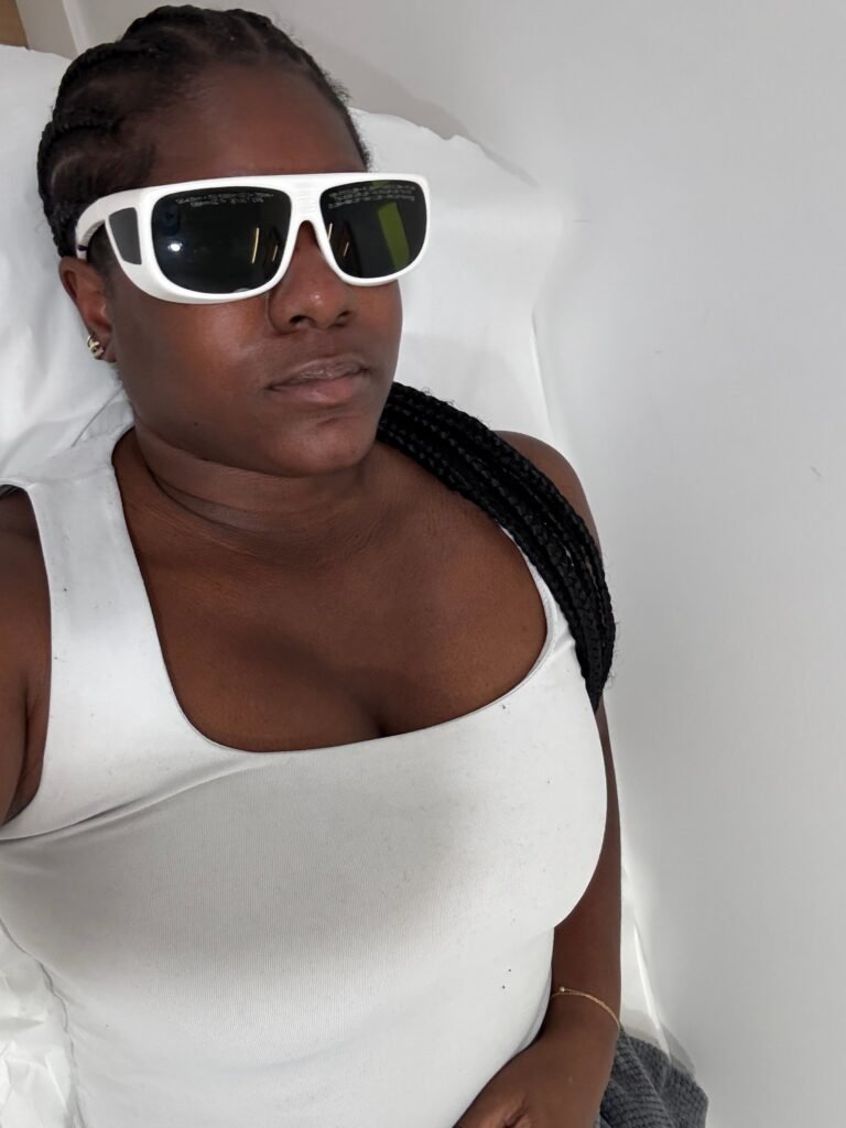 Laser Hair Removal Changed My Confidence